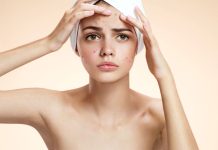 De ce apar cosurile pe frunte