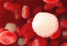 Leucocite in urina
