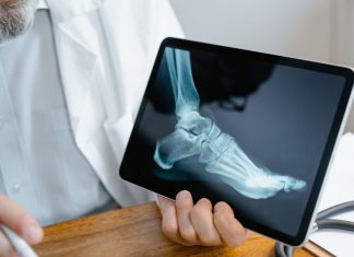 Test osteoporoza